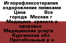 Иглорефлексотерапия, оздоровление пиявками › Цена ­ 3 000 - Все города, Москва г. Медицина, красота и здоровье » Медицинские услуги   . Курганская обл.,Притобольный р-н